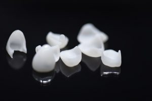 Licówki zębowe