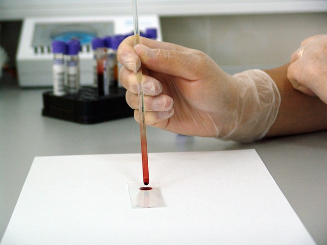 Krew podczas badania w laboratorium